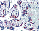 Anti-PARP1 Antibody (clone A6.4.12) IHC-plus LS-B3432