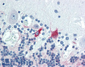 Anti-MAP2 Antibody (clone 5F9) IHC-plus LS-B3439