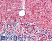 Anti-TNFRSF1A / TNFR1 Antibody (aa29-43) IHC-plus LS-B3441