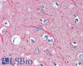 Anti-TUBB / Beta Tubulin Antibody IHC-plus LS-B3442
