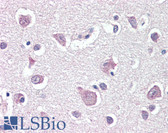 Anti-THY1 / CD90 Antibody (N-Terminus) IHC-plus LS-B3448