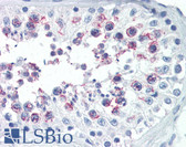 Anti-SMURF1 Antibody (N-Terminus) IHC-plus LS-B3450