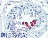 Anti-CCND1 / Cyclin D1 Antibody (Ser90) IHC-plus LS-B3452