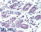 Anti-ABCB5 Antibody (N-Terminus) IHC-plus LS-B3454