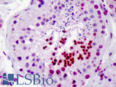 Anti-CDC25A Antibody (Internal) IHC-plus LS-B3457