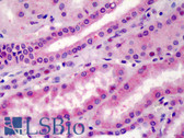 Anti-LRRK2 Antibody (Internal) IHC-plus LS-B3460