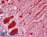Anti-AMACR Antibody (clone 2A10F3) IHC-plus LS-B3468