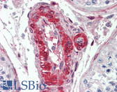 Anti-LIM Protein / LPP Antibody IHC-plus LS-B3472