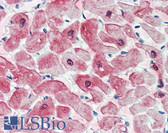 Anti-CRYAB / Alpha B Crystallin Antibody IHC-plus LS-B3474