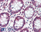 Anti-TCF7L1 Antibody (aa35-84) IHC-plus LS-B3476