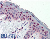 Anti-FRA-1 / FOSL1 Antibody (aa130-179) IHC-plus LS-B3478
