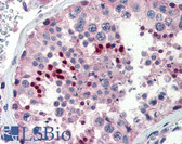Anti-NR0B1 / DAX1 Antibody (aa359-408) IHC-plus LS-B3480