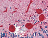 Anti-EMX2 Antibody (N-Terminus) IHC-plus LS-B3481