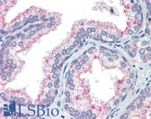 Anti-NAB1 Antibody (aa71-120) IHC-plus LS-B3486