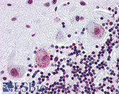 Anti-PAX4 Antibody (aa166-215) IHC-plus LS-B3487