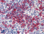 Anti-NCOA3 / SRC-3 / AIB1 Antibody (aa576-625) IHC-plus LS-B3493
