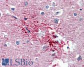 Anti-HMGN1 Antibody (aa36-85) IHC-plus LS-B3496