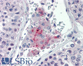 Anti-PAX7 Antibody (aa401-450) IHC-plus LS-B3499