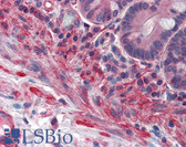 Anti-PRDM5 Antibody (aa36-85) IHC-plus LS-B3500