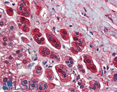 Anti-TCF21 / Epicardin Antibody (aa42-91) IHC-plus LS-B3504