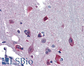 Anti-NR2E1 / TLX Antibody (aa95-144) IHC-plus LS-B3505