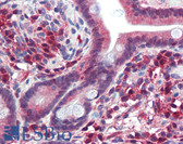Anti-TRIM35 Antibody (aa359-408) IHC-plus LS-B3509
