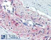 Anti-SSX4 Antibody (aa108-157) IHC-plus LS-B3514