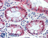 Anti-SCML1 Antibody (aa108-157) IHC-plus LS-B3515