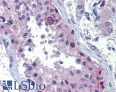 Anti-RHOXF2 Antibody (aa108-157) IHC-plus LS-B3518
