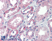 Anti-TRIM68 Antibody (aa395-444) IHC-plus LS-B3531