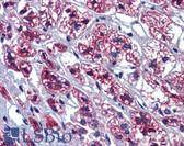 Anti-GTPBP10 Antibody (aa254-303) IHC-plus LS-B3551