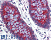 Anti-ABCA5 Antibody (aa1296-1345) IHC-plus LS-B3554
