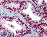 Anti-SLC35A5 Antibody (aa36-85) IHC-plus LS-B3555