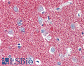 Anti-SLC25A28 Antibody (aa290-339) IHC-plus LS-B3556