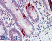 Anti-SLC39A5 / ZIP5 Antibody (aa38-87) IHC-plus LS-B3557