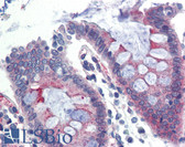 Anti-KLB / Beta Klotho Antibody (Internal) IHC-plus LS-B3568