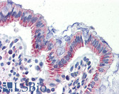 Anti-IMPDH1 Antibody (aa254-303) IHC-plus LS-B3572