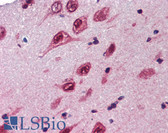 Anti-UBQLN1 / Ubiquilin Antibody (aa290-339) IHC-plus LS-B3574
