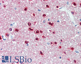 Anti-CBR3 Antibody (clone AT3C5) IHC-plus LS-B3589