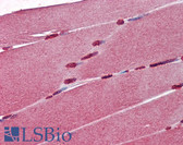 Anti-CRABP1 / CRABP Antibody (clone AT1A1) IHC-plus LS-B3590