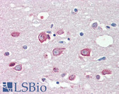 Anti-KMT2B / MLL4 Antibody (C-Terminus) IHC-plus LS-B3595