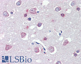 Anti-FEZ1 Antibody (Internal) IHC-plus LS-B3602