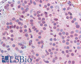 Anti-MBD2 Antibody (Internal) IHC-plus LS-B3603