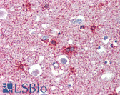 Anti-SEPT2 / Septin 2 Antibody (N-Terminus) IHC-plus LS-B3607