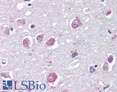 Anti-GABRB3 Antibody (Internal) IHC-plus LS-B3610
