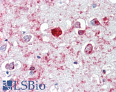 Anti-GABRA6 Antibody (Internal) IHC-plus LS-B3612