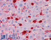 Anti-S100A9 / MRP14 Antibody (Internal) IHC-plus LS-B3613