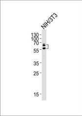 Anti-DPYSL2 / CRMP2 Antibody (clone 33CT11.40.3) IHC-plus LS-B3616