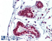Anti-PRMT1 Antibody (C-Terminus) IHC-plus LS-B3619