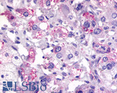 Anti-CXCR2 Antibody (N-Terminus) IHC-plus LS-A803